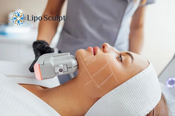 HIFU vs Botulinum Toxin: Understanding the Differences 1 HIFU vs Botox Waltham Cross What is the best option for you?