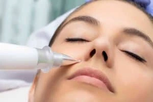 Best Actinic Keratoses Removal 3 Actinic keratoses Waltham Cross solutions - book in today!